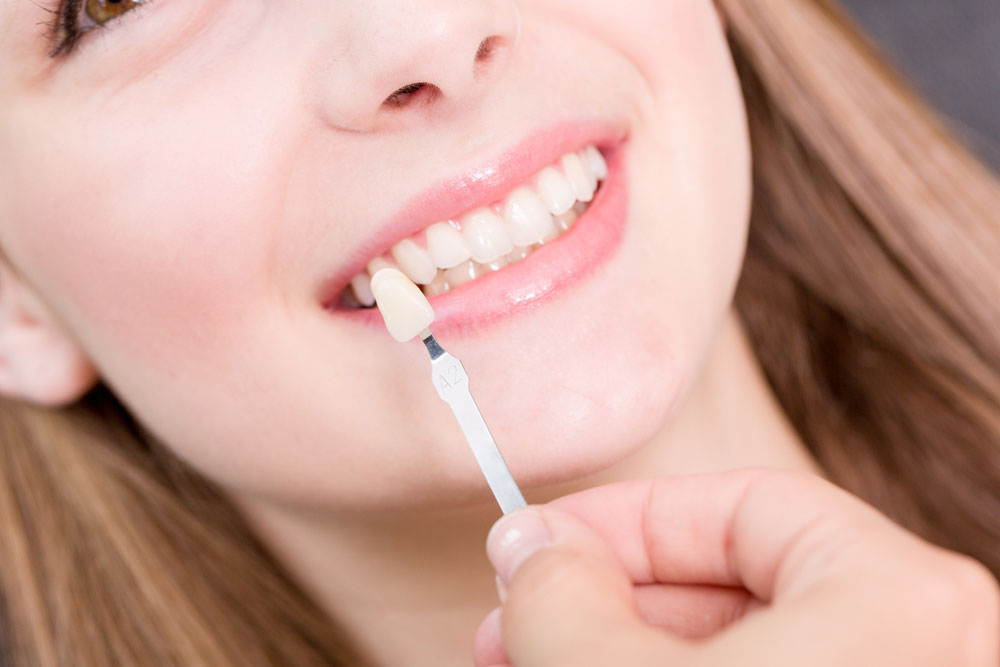 How Dental Implants Is Gaining Fast Popularity In Birmingham