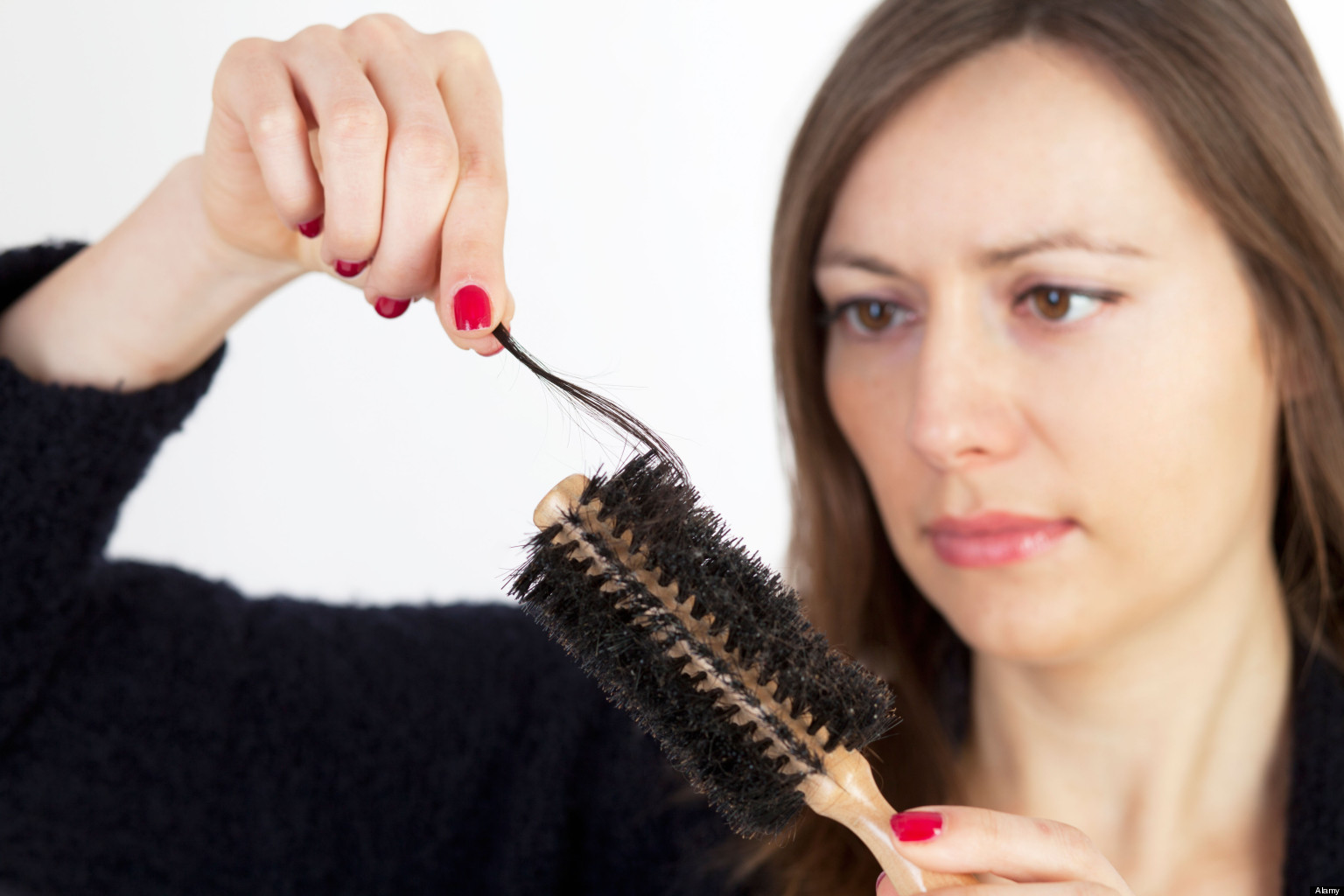 Approach The Best Specialist  To Get Hair Loss Treatment