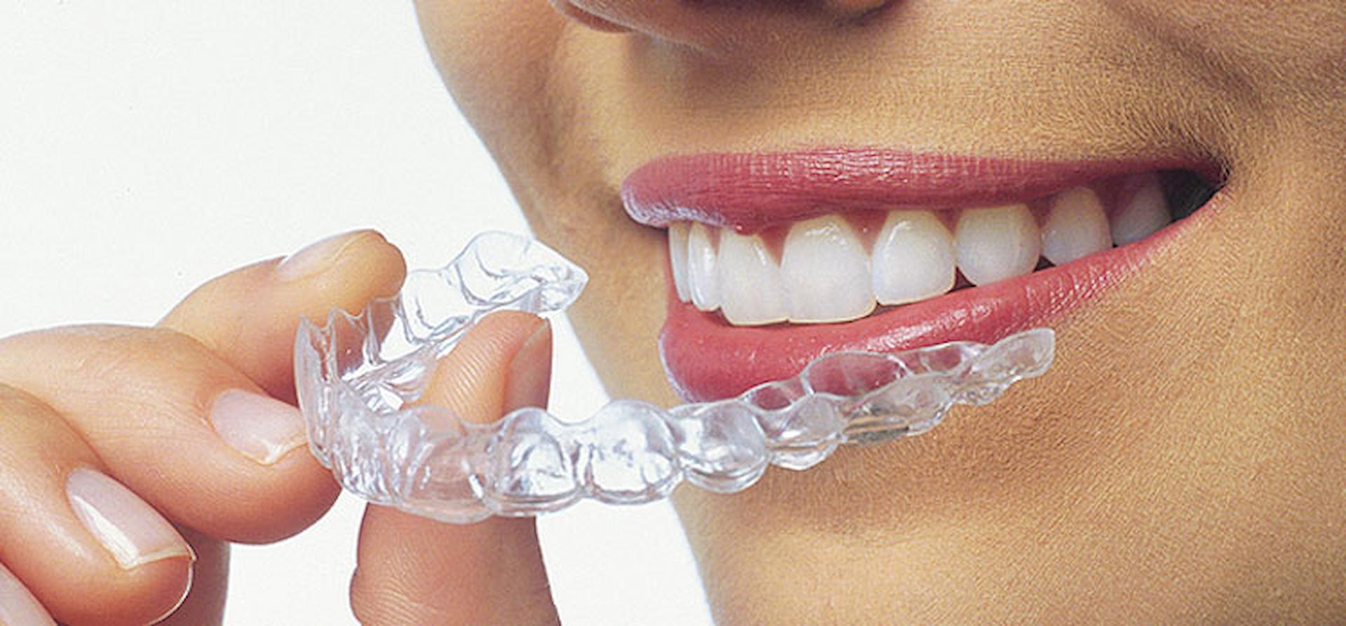 Reasons Why Invisalign Is The Most Superior Choice For Your Teeth