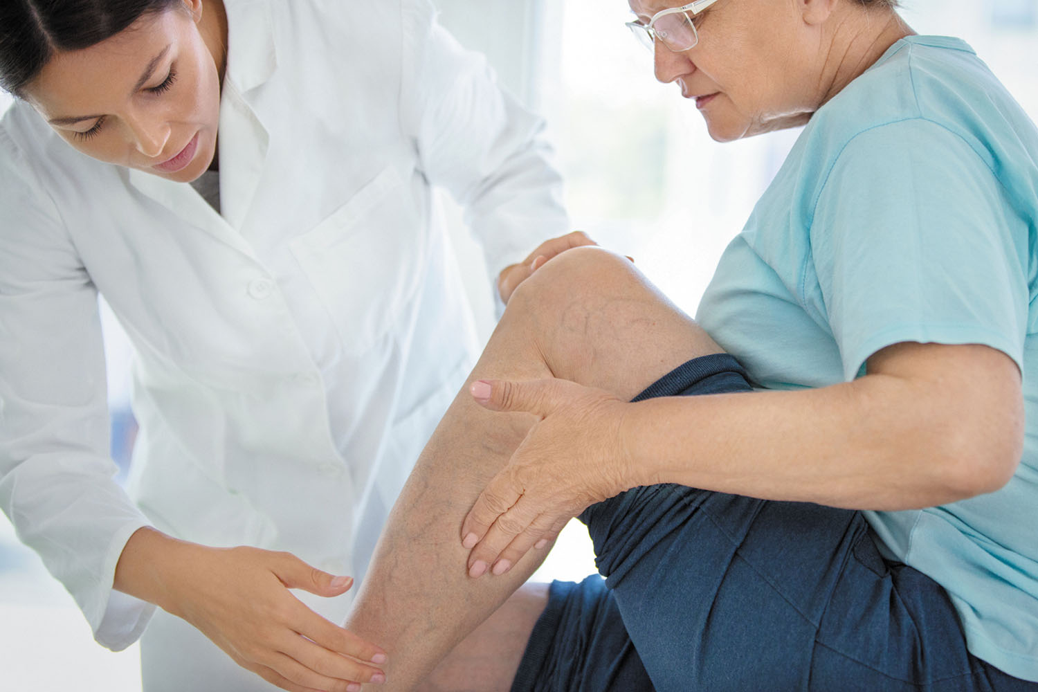 The Most Trusted And Effective Ways To Treat Varicose Veins