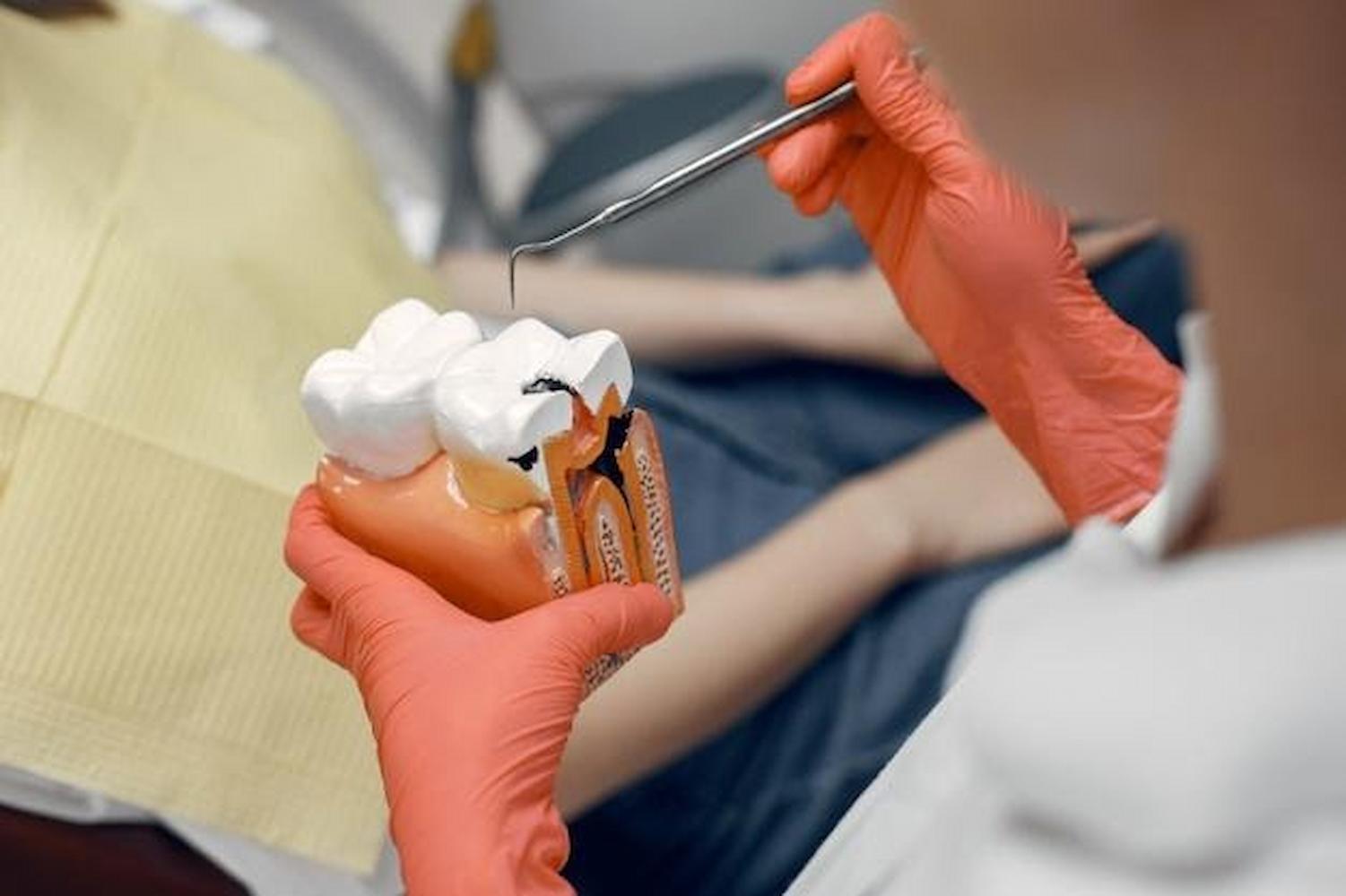 A Serious Dental Problem Called Cavities